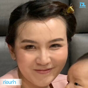 จมูก open