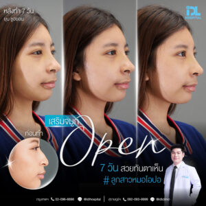 จมูก open