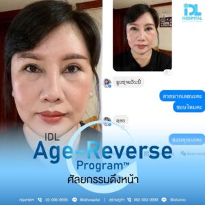 รีวิว ดึงหน้า