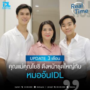 รีวิว ดึงหน้า
