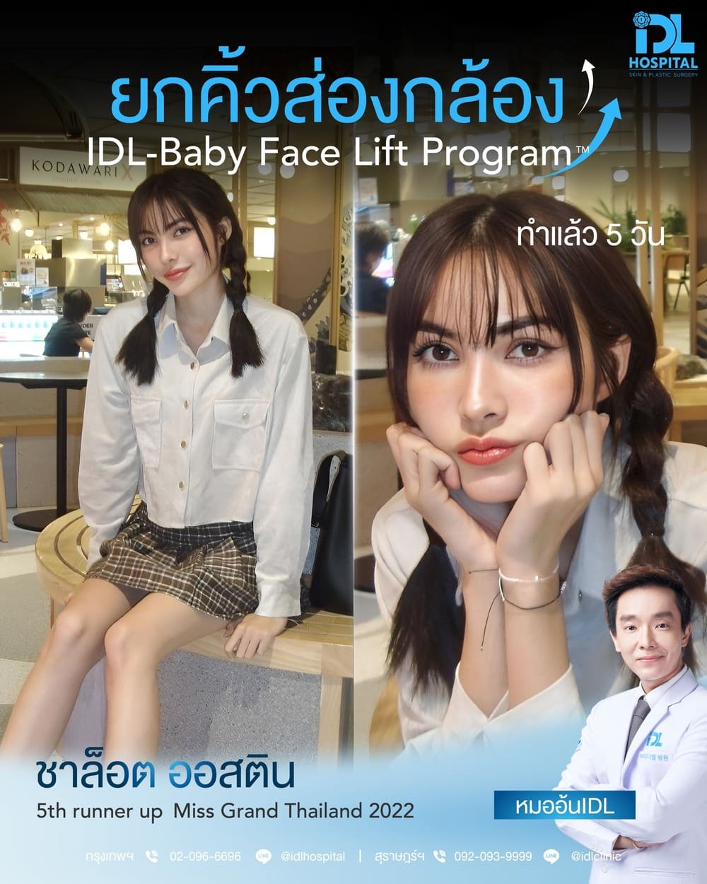 ยกคิ้วส่องกล้อง IDL