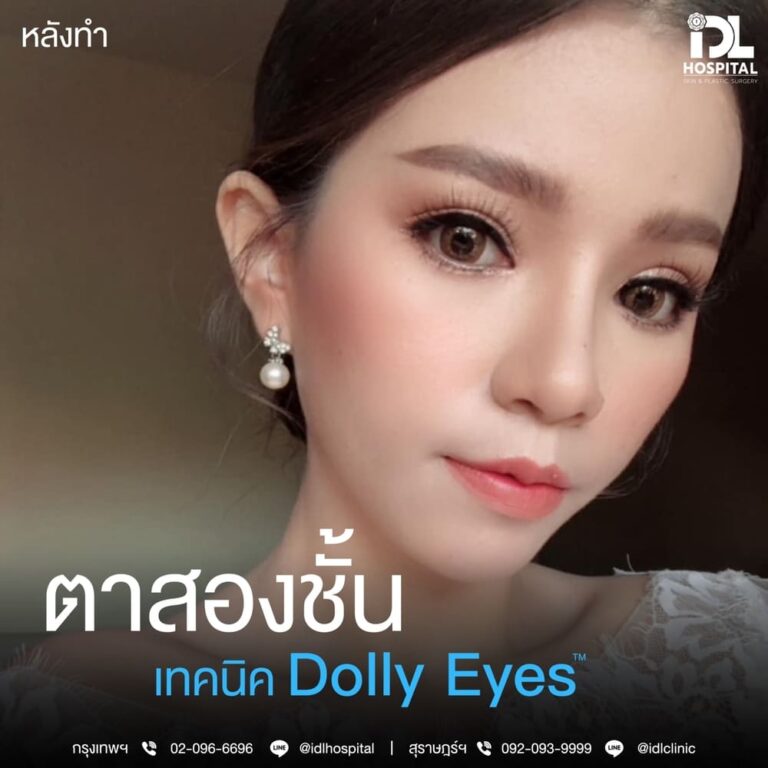 ตาสองชั้น Dolly Eyes