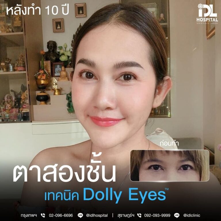 ตาสองชั้น Dolly Eyes