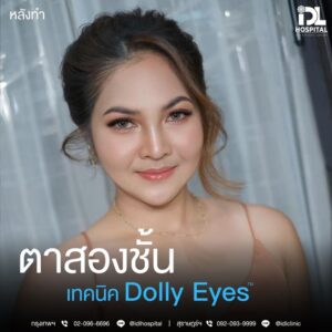 ตาสองชั้น Dolly Eyes