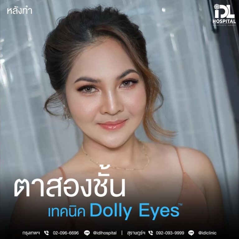 ตาสองชั้น Dolly Eyes