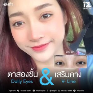 ตาสองชั้น Dolly Eyes