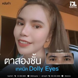 ตาสองชั้น Dolly Eyes