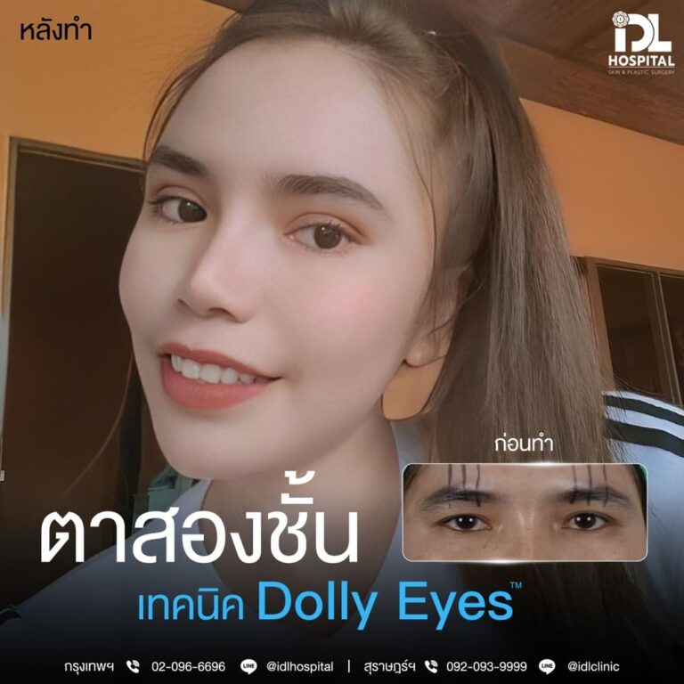ตาสองชั้น Dolly Eyes