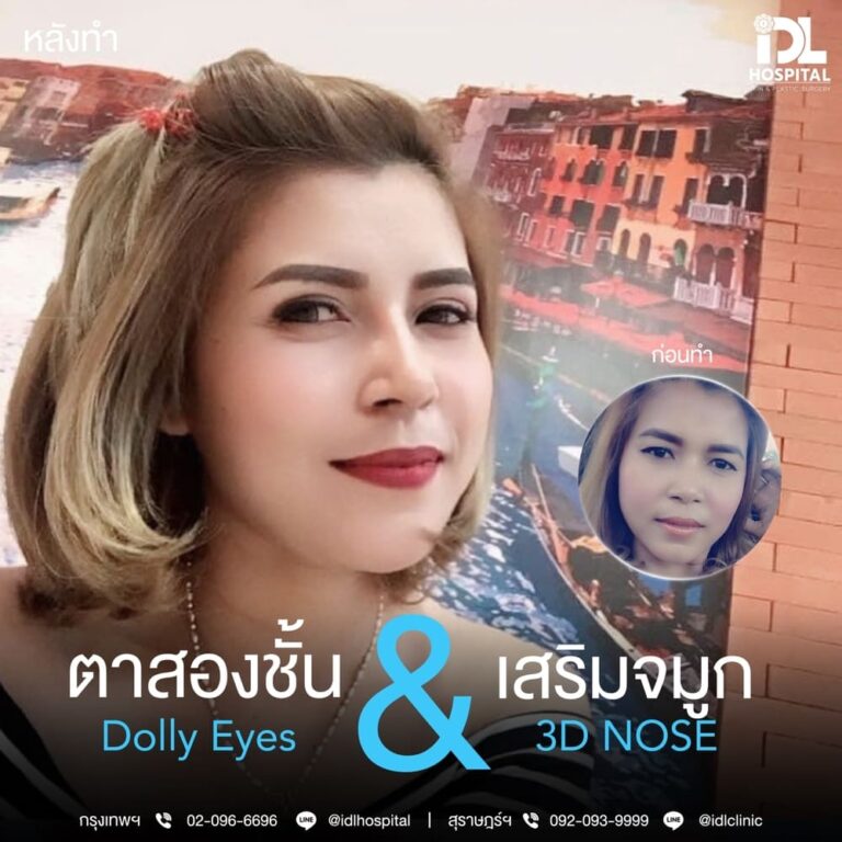 ตาสองชั้น Dolly Eyes