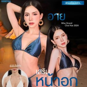 เสริมหน้าอก