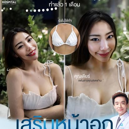 เสริมหน้าอก