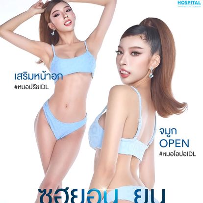 เสริมหน้าอก