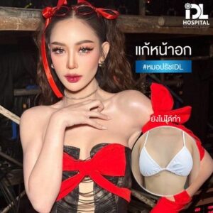 เสริมหน้าอก