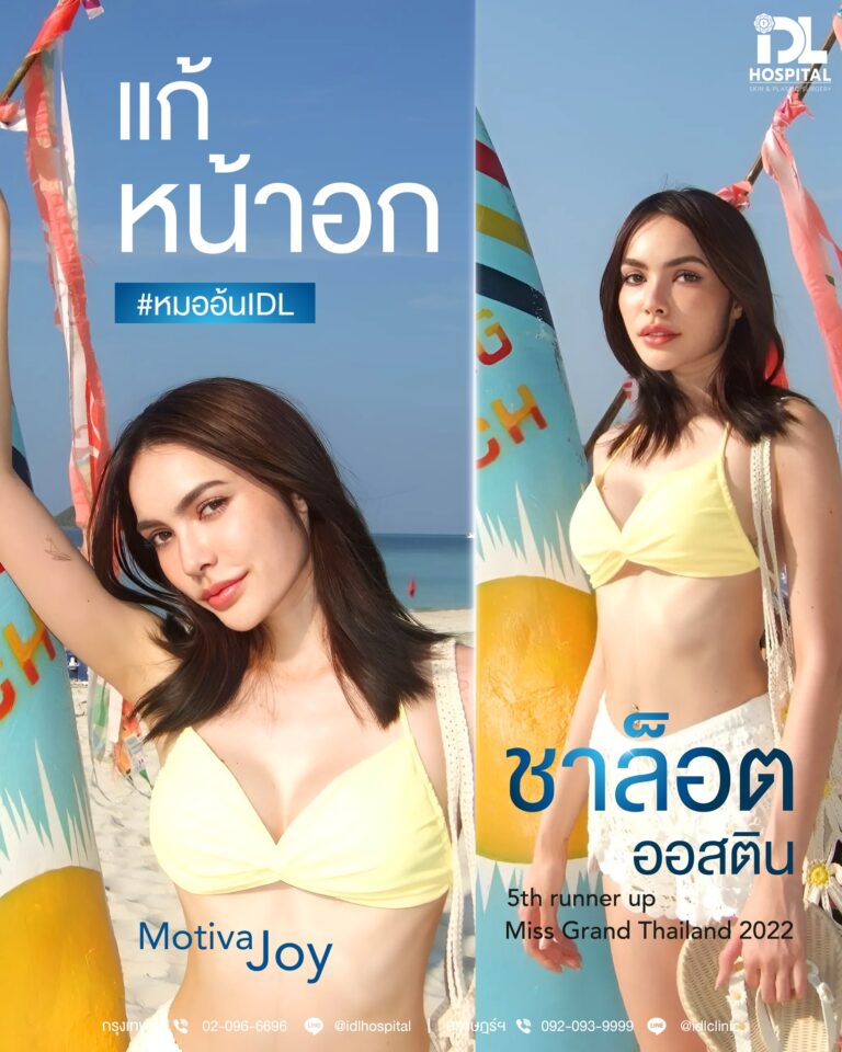 เสริมหน้าอก