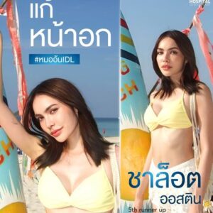 เสริมหน้าอก