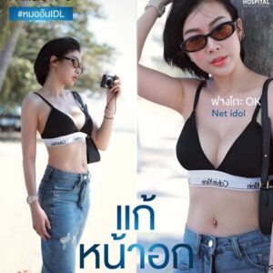 เสริมหน้าอก