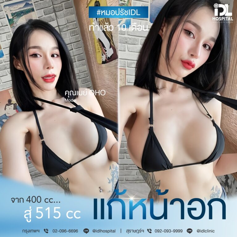 เสริมหน้าอก