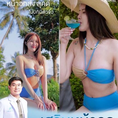 เสริมหน้าอก