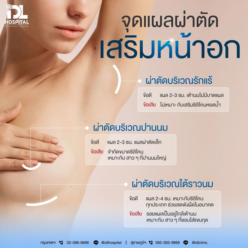 แผลผ่าตัดเสริมหน้าอกมีกี่แบบ
