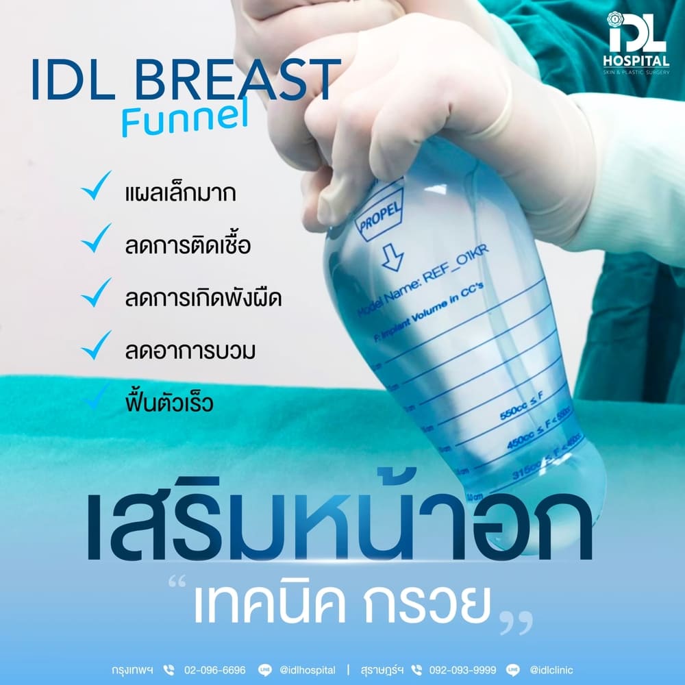 เสริมหน้าอก IDL ด้วยเทคนิคกรวย