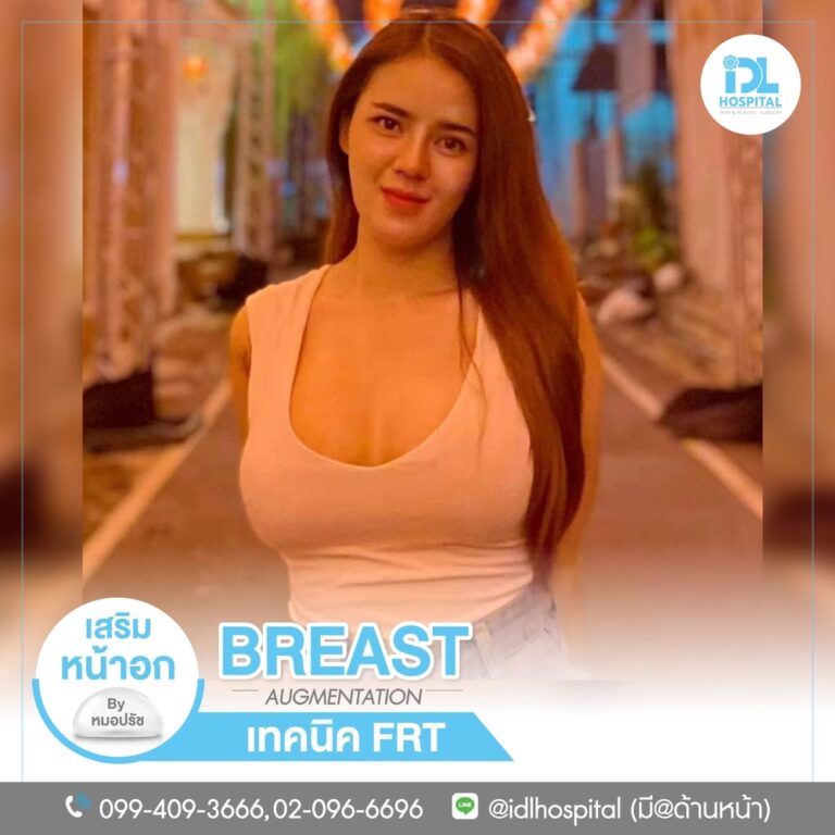 รีวิว เสริมหน้าอก