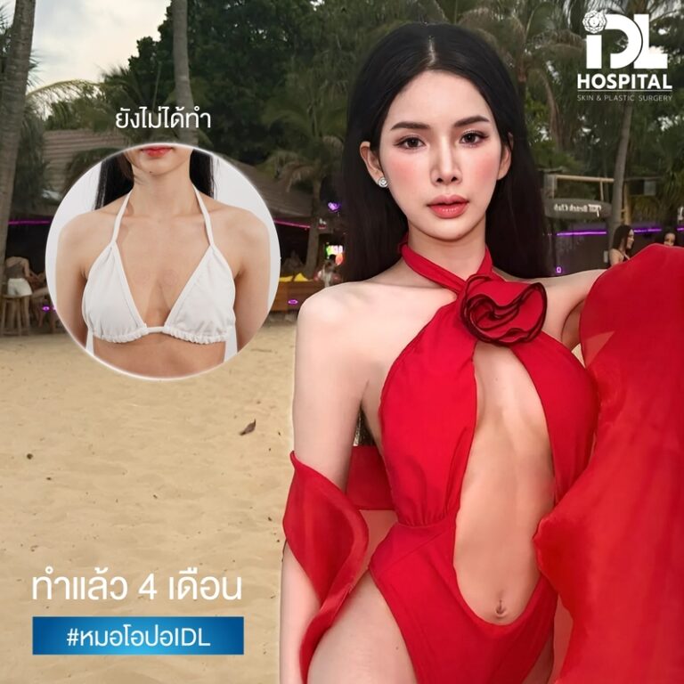 เสริมหน้าอก