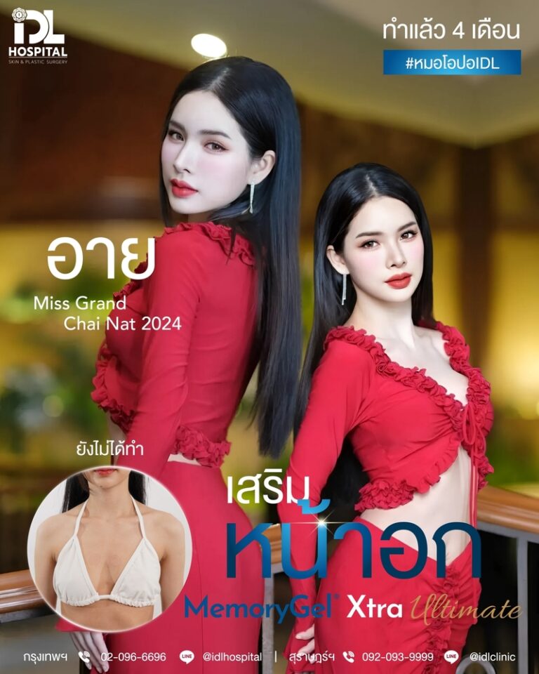 รีวิว เสริมหน้าอก