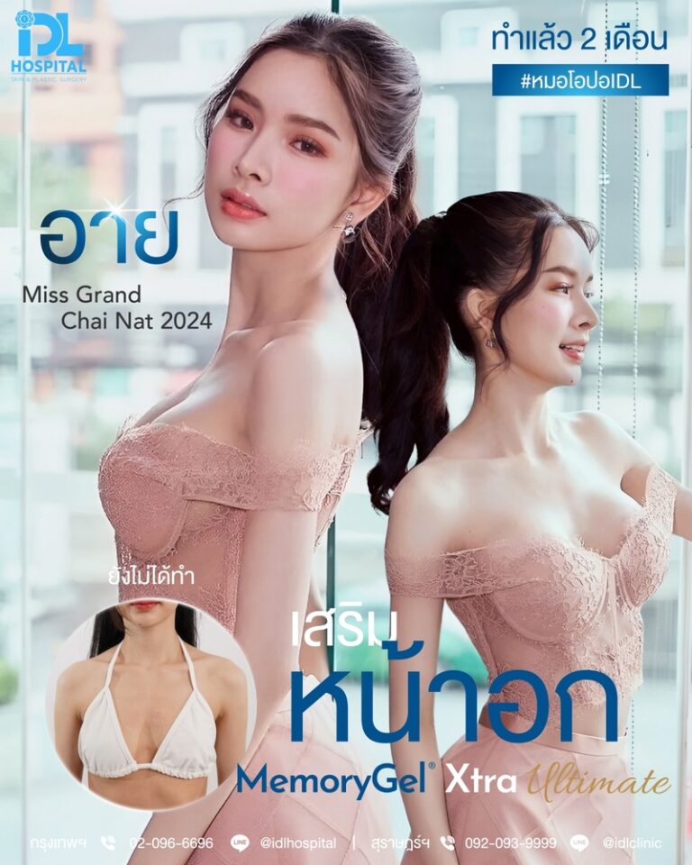 รีวิว เสริมหน้าอก