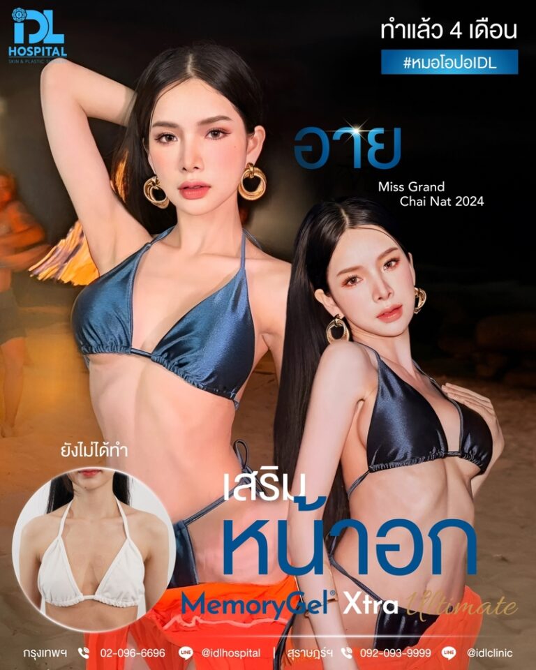 รีวิว เสริมหน้าอก