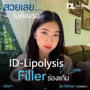 lipo
