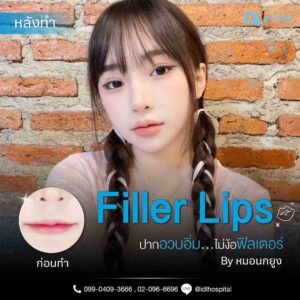 Filler