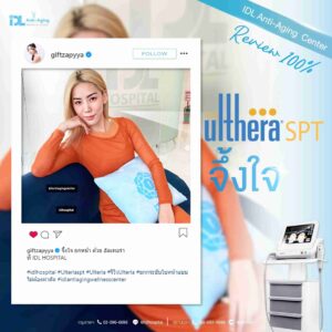 review ulthera