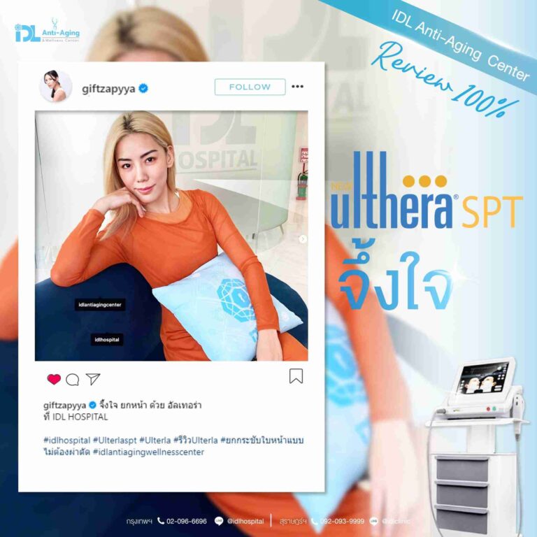 review ulthera