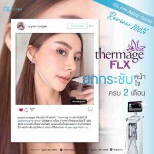 thermage