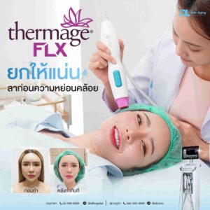 thermage