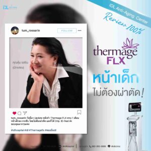 thermage