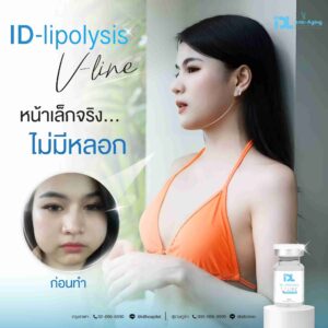 lipo