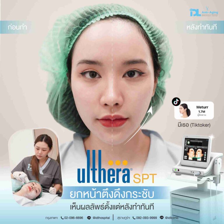 review ulthera
