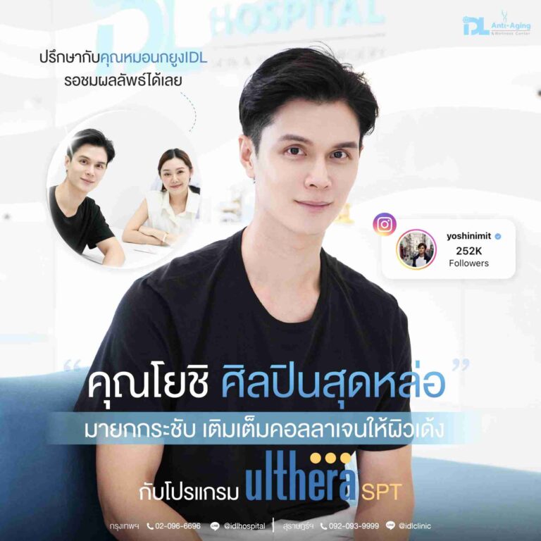 review ulthera