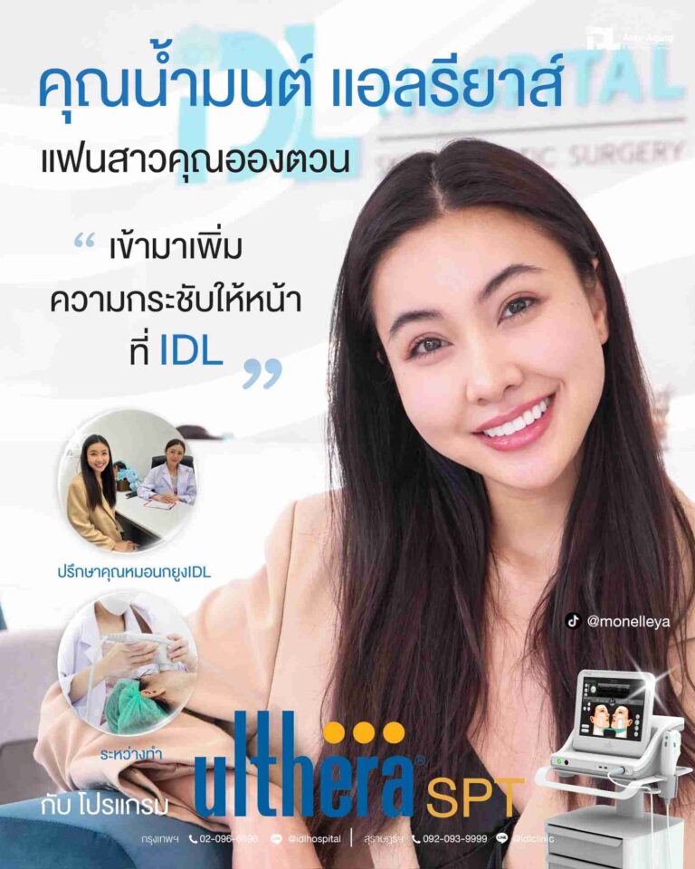 review ulthera