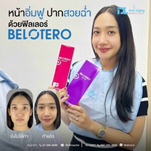 Filler Belotero