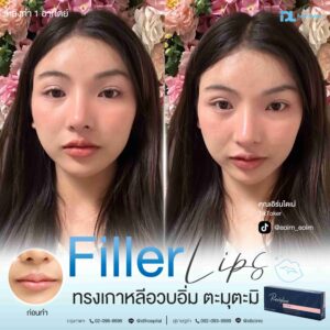 Filler