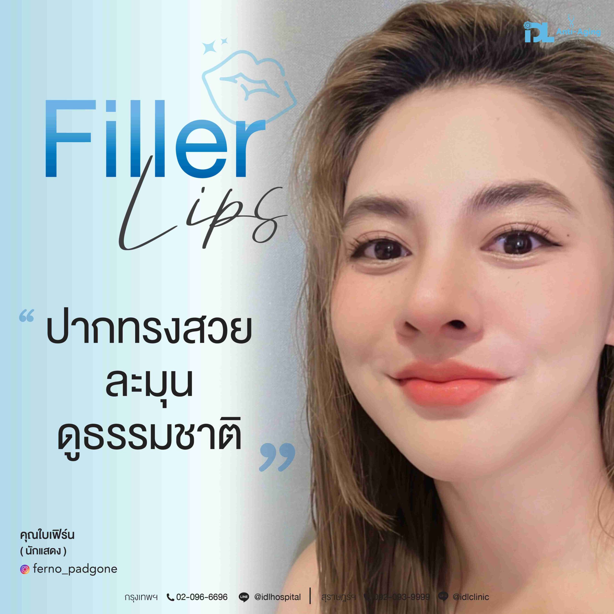 Filler Lips ปากทรงหวาน สวยธรรมชาติ 2