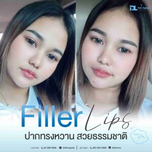 Filler
