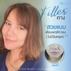 Filler