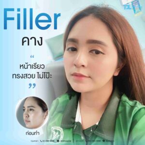 Filler