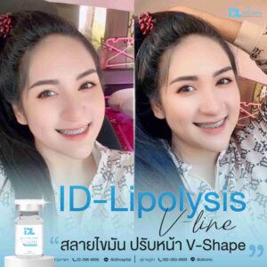 lipo