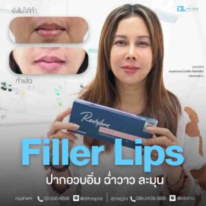 Filler