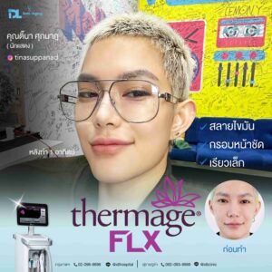 thermage