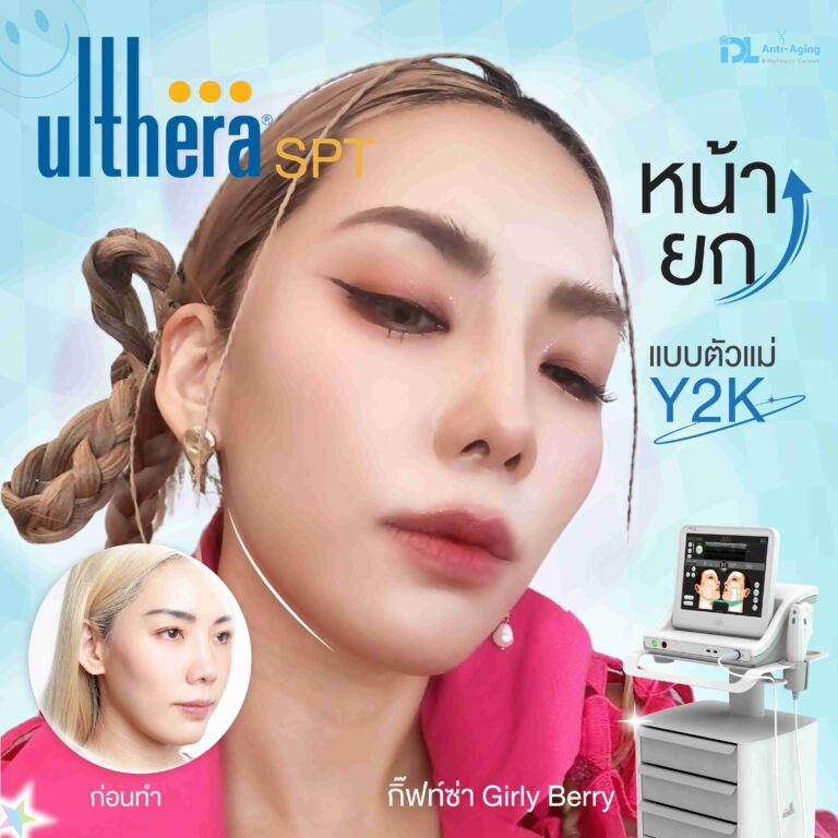 review ulthera